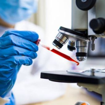 La prise d'essai et les dilutions des produits en vue de leur analyse microbiologique